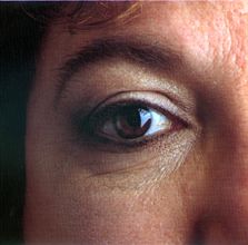 National_Eye_Institute