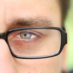 dry_eye_Nebojsa_Markovic_Shutterstock