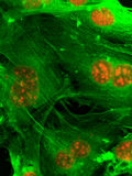 emerging cancer cells