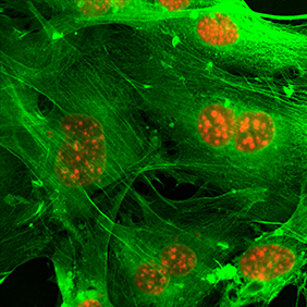 emerging cancer cells NCI Center for Cancer Research