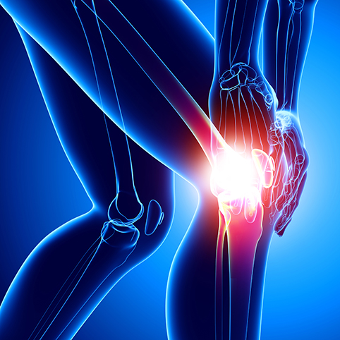 knee replacement 